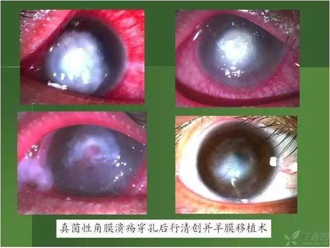 ����������Խ�Ĥ�׵ĸ��廯�ۺ����� ���£�