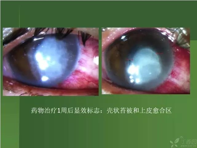 ����������Խ�Ĥ�׵ĸ��廯�ۺ����� ���£�