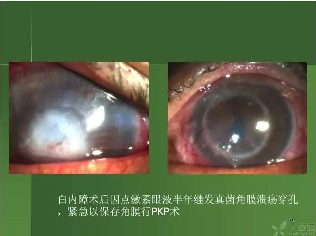 ����������Խ�Ĥ�׵ĸ��廯�ۺ����� ���£�