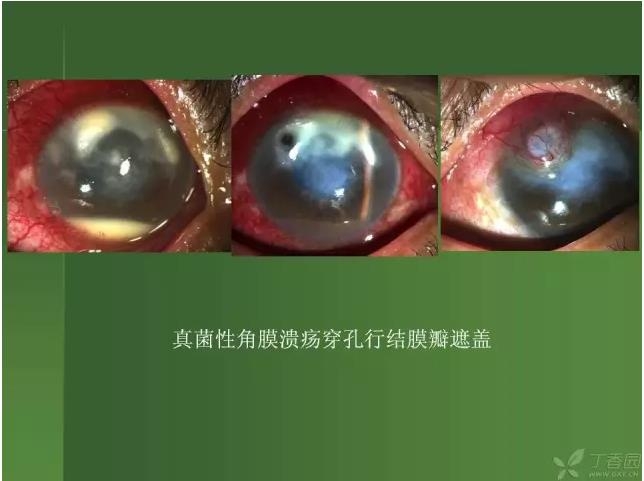 ����������Խ�Ĥ�׵ĸ��廯�ۺ����� ���£�