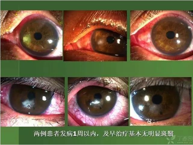 ����������Խ�Ĥ�׵ĸ��廯�ۺ����� ���£�