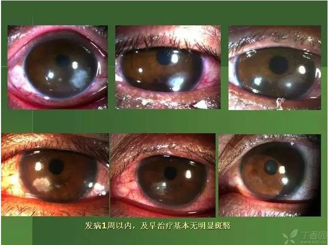 ����������Խ�Ĥ�׵ĸ��廯�ۺ����� ���£�