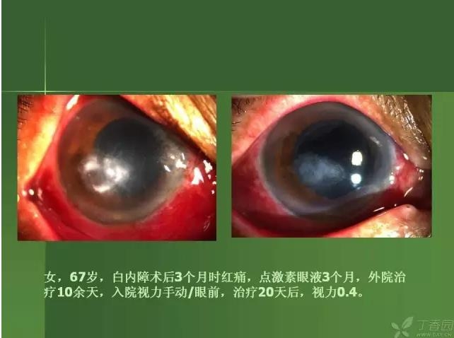 ����������Խ�Ĥ�׵ĸ��廯�ۺ����� ���£�