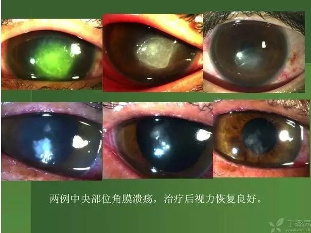 ����������Խ�Ĥ�׵ĸ��廯�ۺ����� ���£�