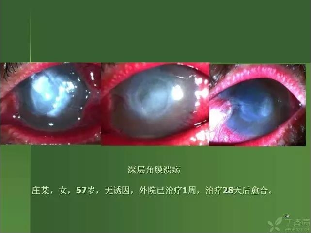 ����������Խ�Ĥ�׵ĸ��廯�ۺ����� ���£�