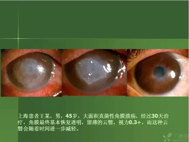 ����������Խ�Ĥ�׵ĸ��廯�ۺ����� ���£�