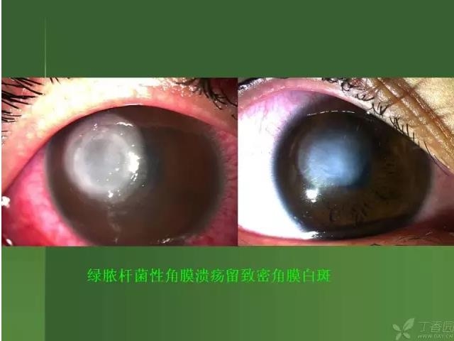 ����������Խ�Ĥ�׵ĸ��廯�ۺ����� ���£�