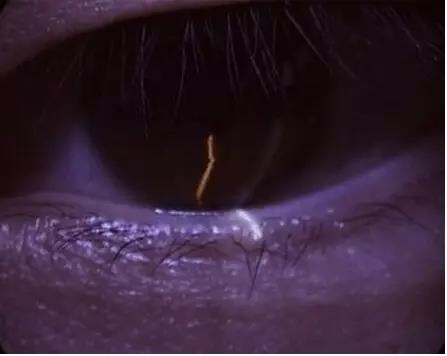 ��϶�Ƽ������