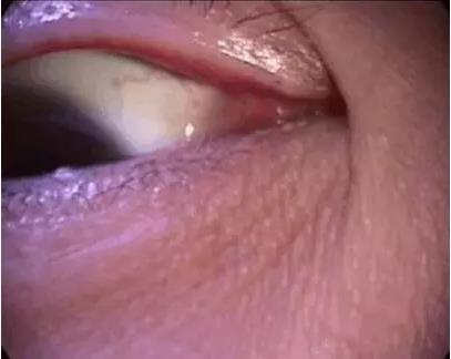 ��϶�Ƽ������