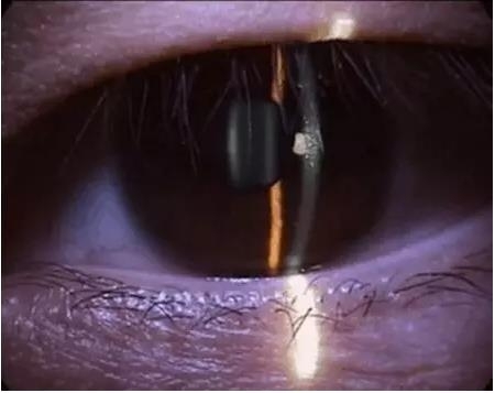 ��϶�Ƽ������