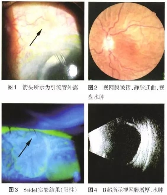 ���������������������¶�µ���ѹ�ۺ���һ��