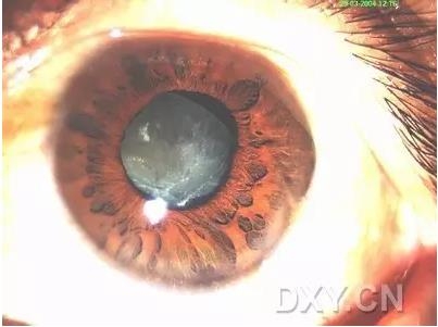 �ۿ�ҽ���ٴ����۸�����ǰ��ͼ��