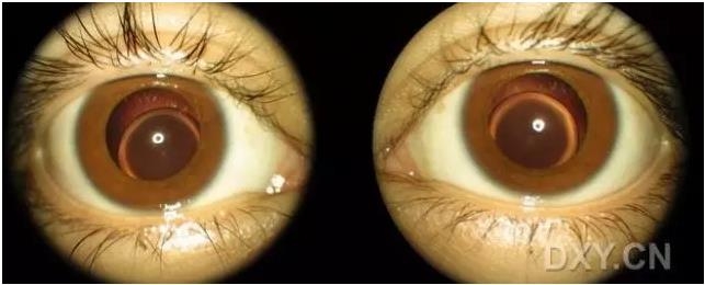 �ۿ�ҽ���ٴ����۸�����ǰ��ͼ��