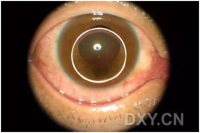 �ۿ�ҽ���ٴ����۸�����ǰ��ͼ��