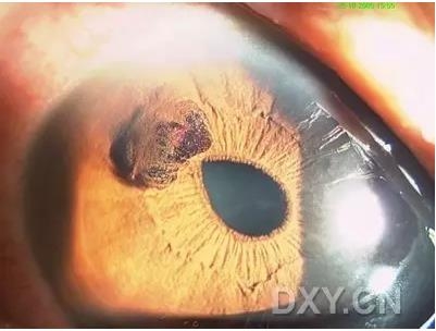 �ۿ�ҽ���ٴ����۸�����ǰ��ͼ��