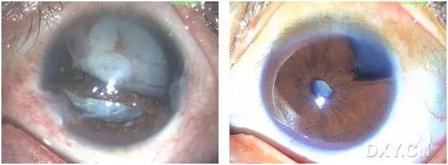 �ۿ�ҽ���ٴ����۸�����ǰ��ͼ��