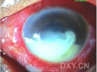 �ۿ�ҽ���ٴ����۸�����ǰ��ͼ��