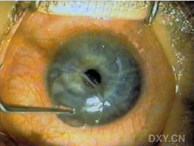 �ۿ�ҽ���ٴ����۸�����ǰ��ͼ��