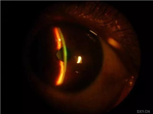 �ۿ�ҽ���ٴ����۸�����ǰ��ͼ��