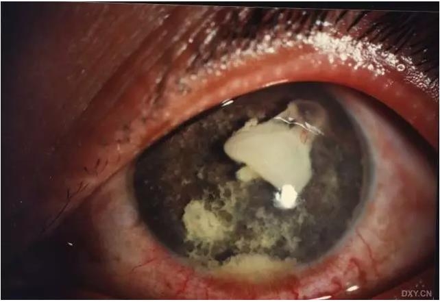 �ۿ�ҽ���ٴ����۸�����ǰ��ͼ��