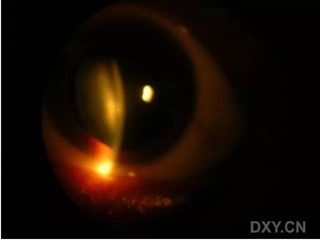 �ۿ�ҽ���ٴ����۸�����ǰ��ͼ��