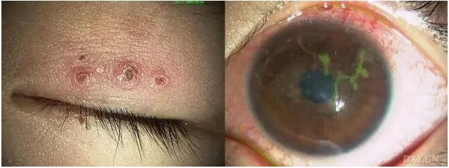 �ۿ�ҽ���ٴ����۸�����ǰ��ͼ��