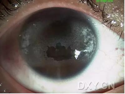 �ۿ�ҽ���ٴ����۸�����ǰ��ͼ��