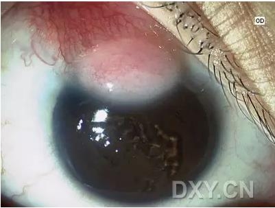 �ۿ�ҽ���ٴ����۸�����ǰ��ͼ��