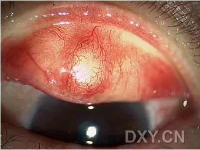 �ۿ�ҽ���ٴ����۸�����ǰ��ͼ��