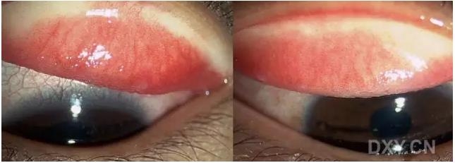 �ۿ�ҽ���ٴ����۸�����ǰ��ͼ��