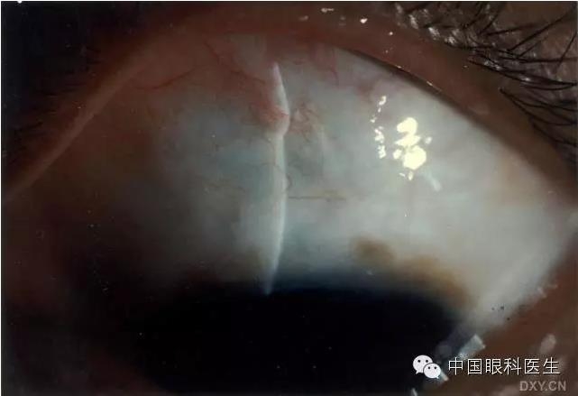 ������˹�����̬�ּ�����׼��Ƭ