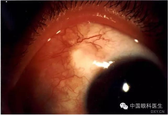 ������˹�����̬�ּ�����׼��Ƭ