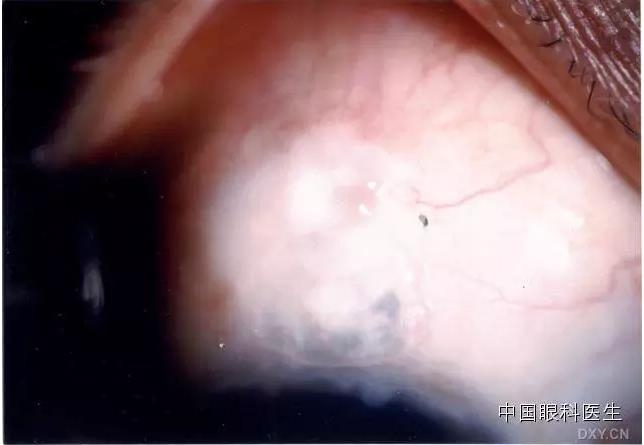 ������˹�����̬�ּ�����׼��Ƭ