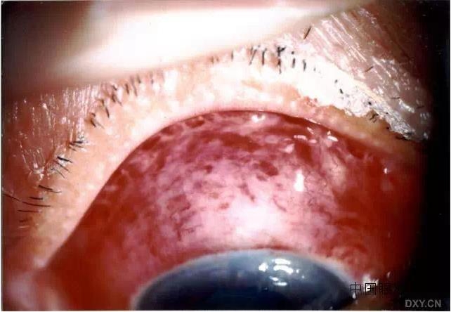 ������˹�����̬�ּ�����׼��Ƭ