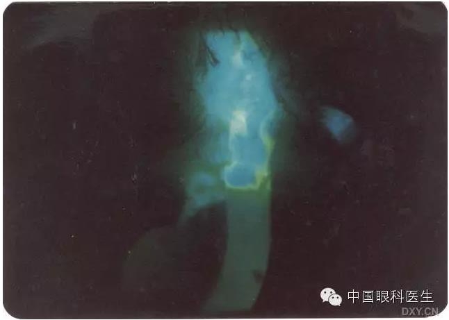 ������˹�����̬�ּ�����׼��Ƭ