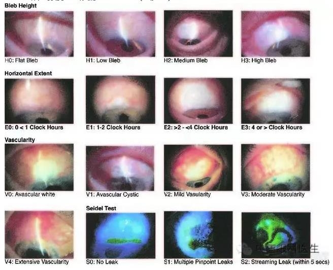 ������˹�����̬�ּ�����׼��Ƭ