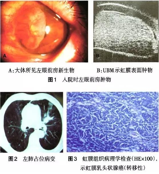 ����������Ĥת������ͷ״�ٰ�һ��