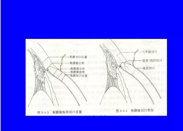 �ۿ���΢������е���������ܣ��ϣ�