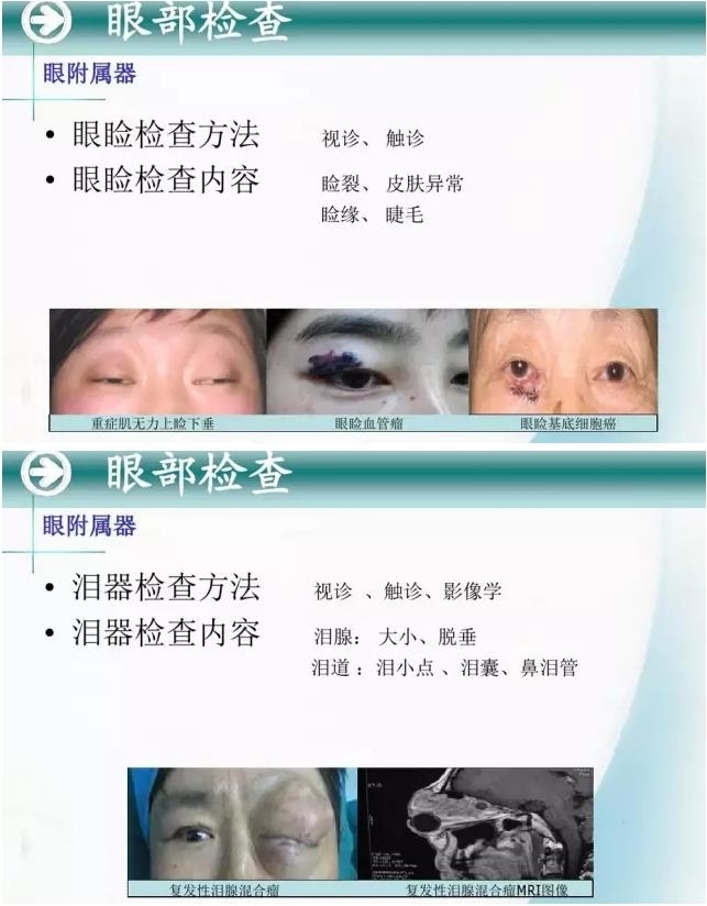 �ۿ�ѧ���ü�鷨