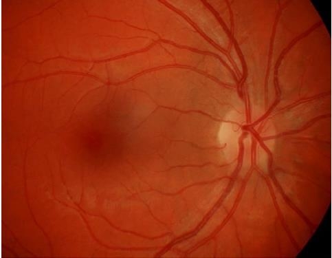 Pract Neurol ��־��������������ʵ���ٴ�����е�����