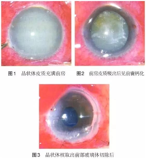 ����������״���ܽ��������һ��