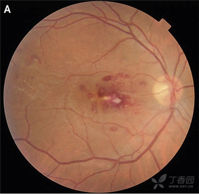 ͼ6 ��Ⱦ������Ĥ��.jpg