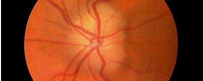 ���·��֣��۲����ɿ����������ɭ֢