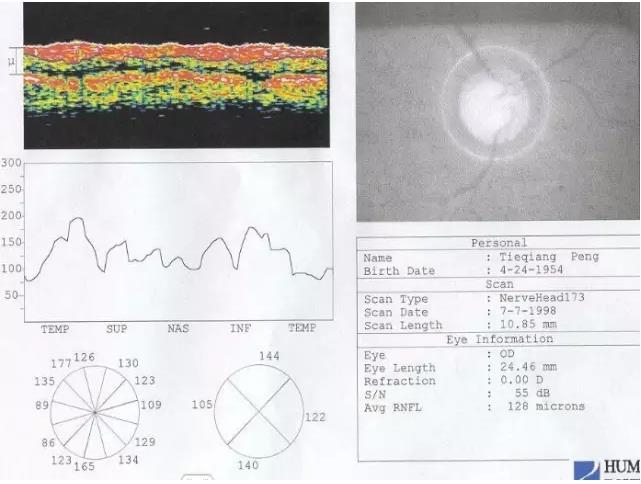 OCT���ۿ��ٴ�����е�Ӧ��