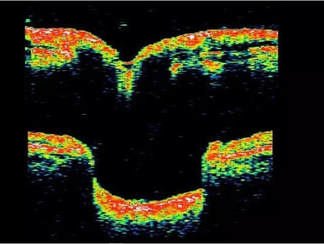 OCT���ۿ��ٴ�����е�Ӧ��