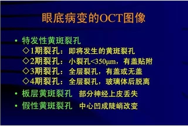 OCT���ۿ��ٴ�����е�Ӧ��