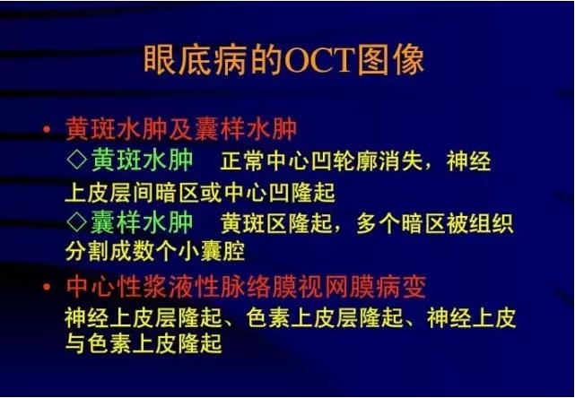 OCT���ۿ��ٴ�����е�Ӧ��