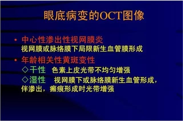 OCT���ۿ��ٴ�����е�Ӧ��