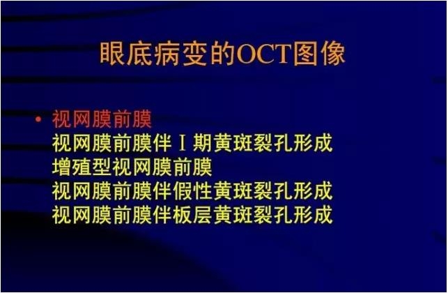 OCT���ۿ��ٴ�����е�Ӧ��