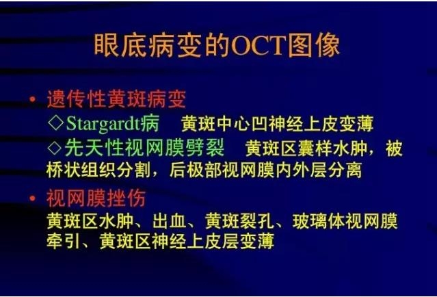 OCT���ۿ��ٴ�����е�Ӧ��